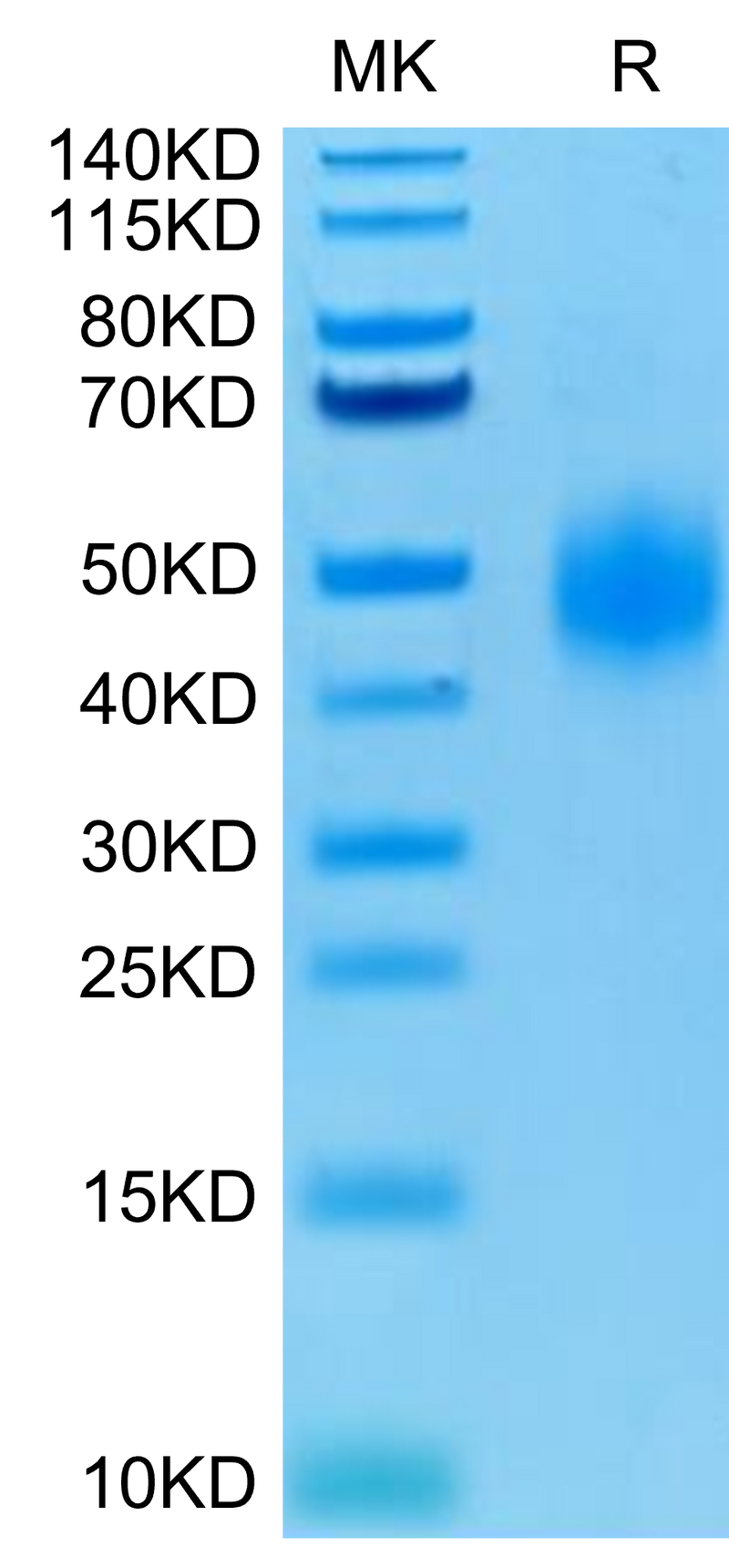 Human CD47 on Tris-Bis PAGE under reduced condition. The purity is greater than 95%.Recombinant Human CD47 Protein, Active