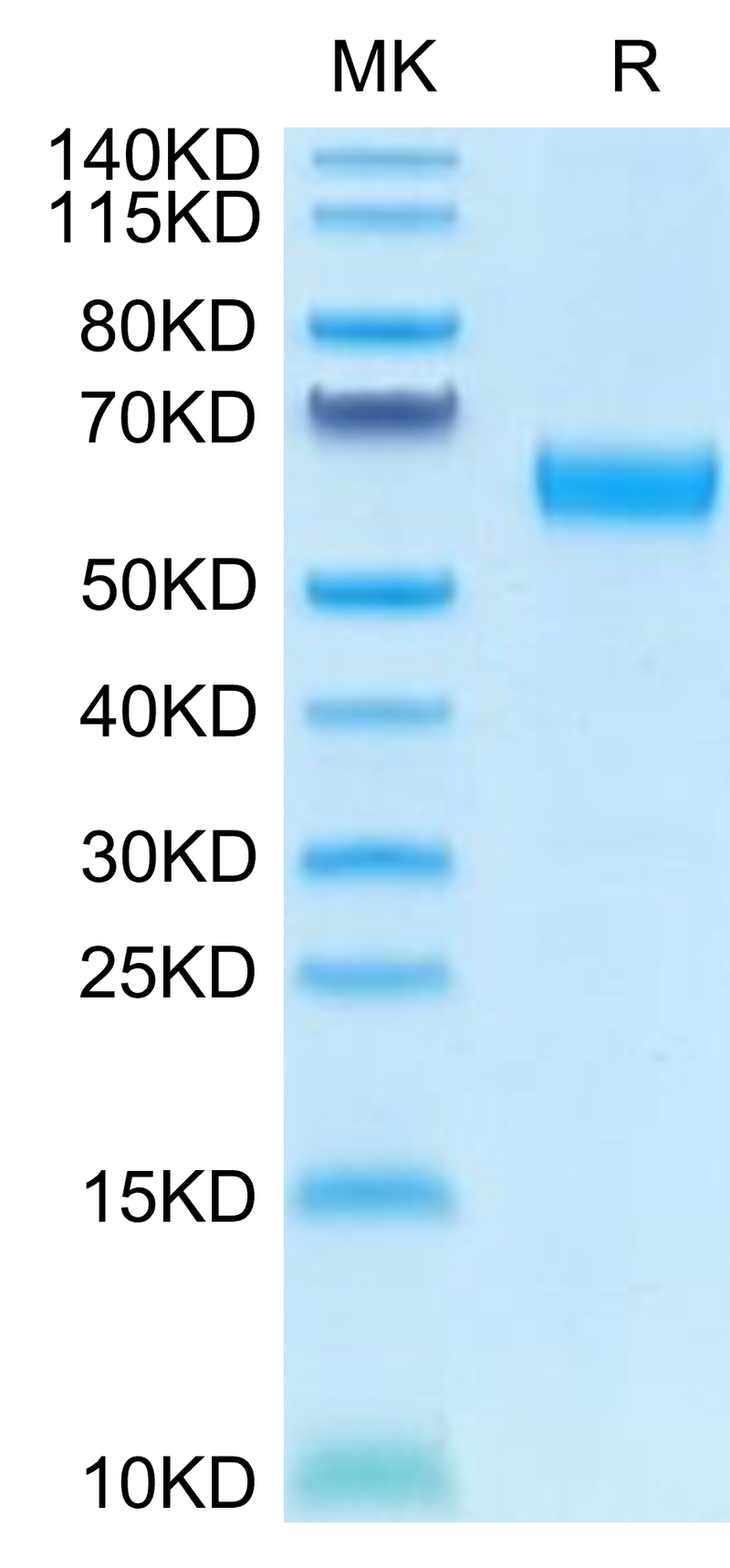 Human CD47 on Tris-Bis PAGE under reduced condition. The purity is greater than 95%.Recombinant Human CD47 Protein, Active