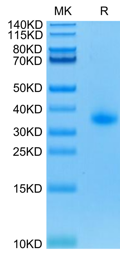 Human CD40 on Tris-Bis PAGE under reduced condition. The purity is greater than 95%.Recombinant Human CD40/TNFRSF5 Protein, Active