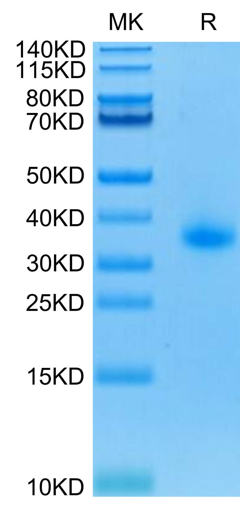 Human CD40 on Tris-Bis PAGE under reduced condition. The purity is greater than 95%.Recombinant Human CD40/TNFRSF5 Protein, Active