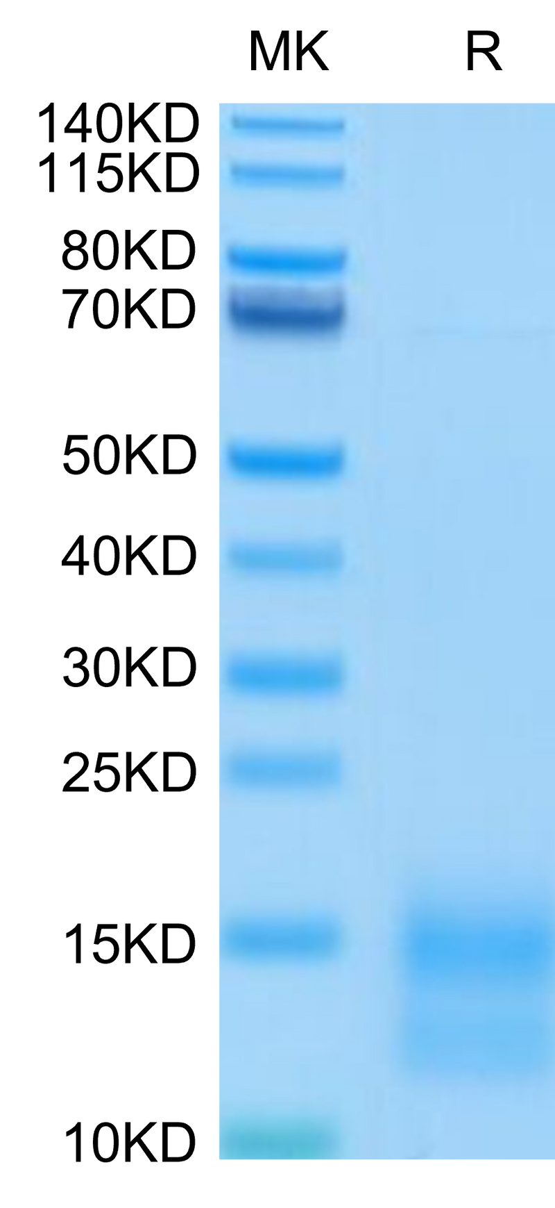 Mouse BCMA on Tris-Bis PAGE under reduced condition. The purity is greater than 95%.Recombinant Mouse BCMA/TNFRSF17 Protein, Active