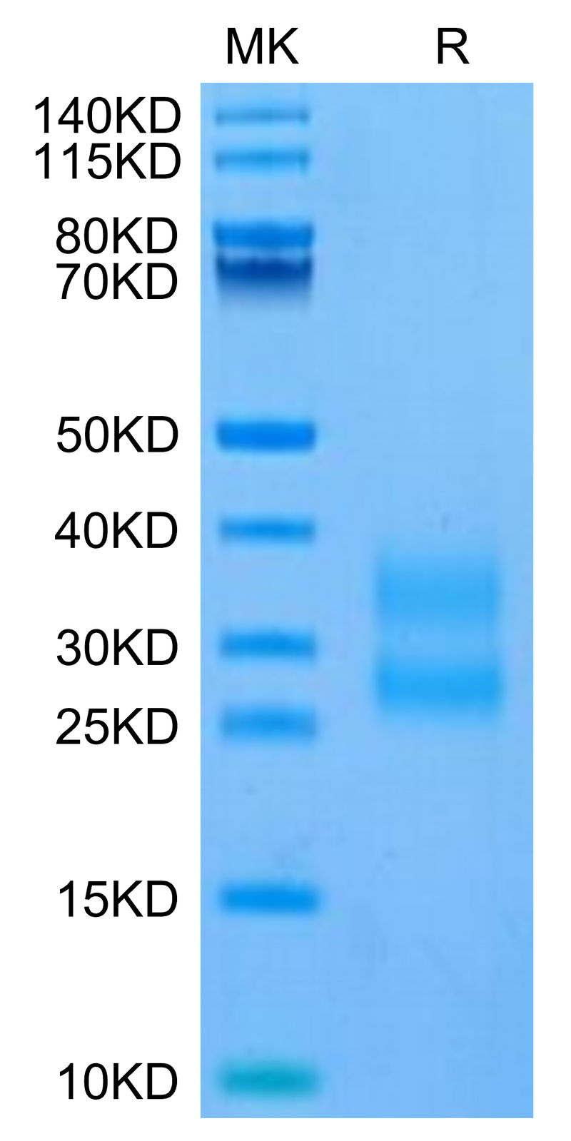 Mouse ICOS (C137S, C138S) on Tris-Bis PAGE under reduced condition. The purity is greater than 95%.Recombinant Mouse ICOS/CD278 (C137S, C138S) Protein