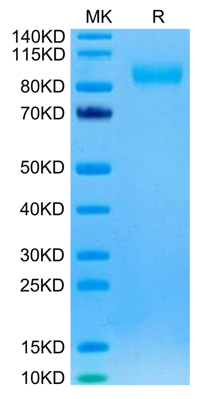 Rhesus macaque EGFR on Tris-Bis PAGE under reduced condition. The purity is greater than 95%.Recombinant Rhesus macaque EGFR/HER1 Protein, Active