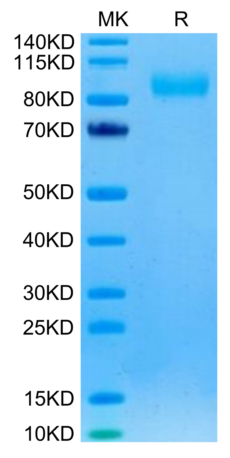 Rhesus macaque EGFR on Tris-Bis PAGE under reduced condition. The purity is greater than 95%.Recombinant Rhesus macaque EGFR/HER1 Protein, Active