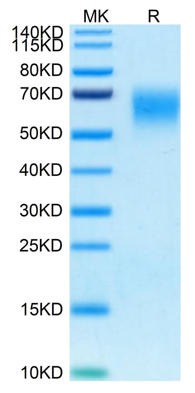 Human CD200 R1 on Tris-Bis PAGE under reduced condition. The purity is greater than 95%.Recombinant Human CD200 R1/CRTR2 Protein, Active