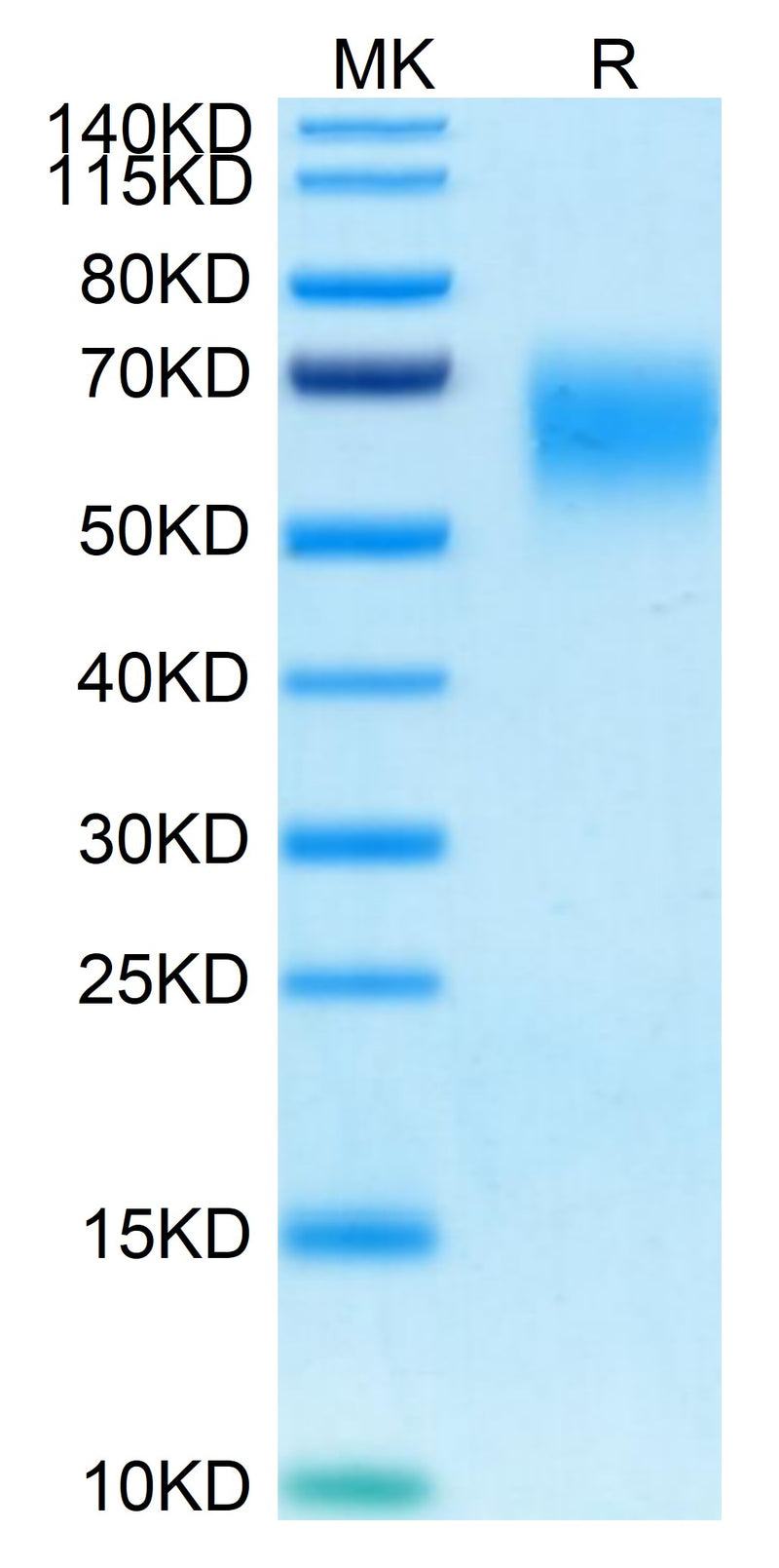 Human CD200 R1 on Tris-Bis PAGE under reduced condition. The purity is greater than 95%.Recombinant Human CD200 R1/CRTR2 Protein, Active
