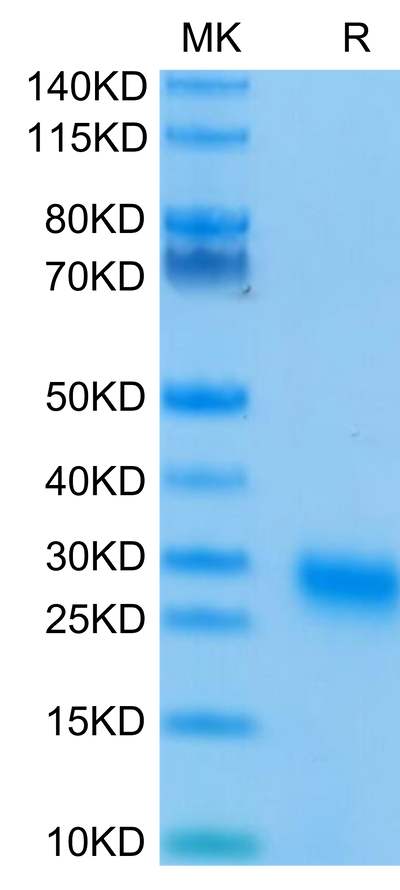 Human GITR on Tris-Bis PAGE under reduced condition. The purity is greater than 95%Recombinant Human GITR/TNFRSF18 Protein, Active