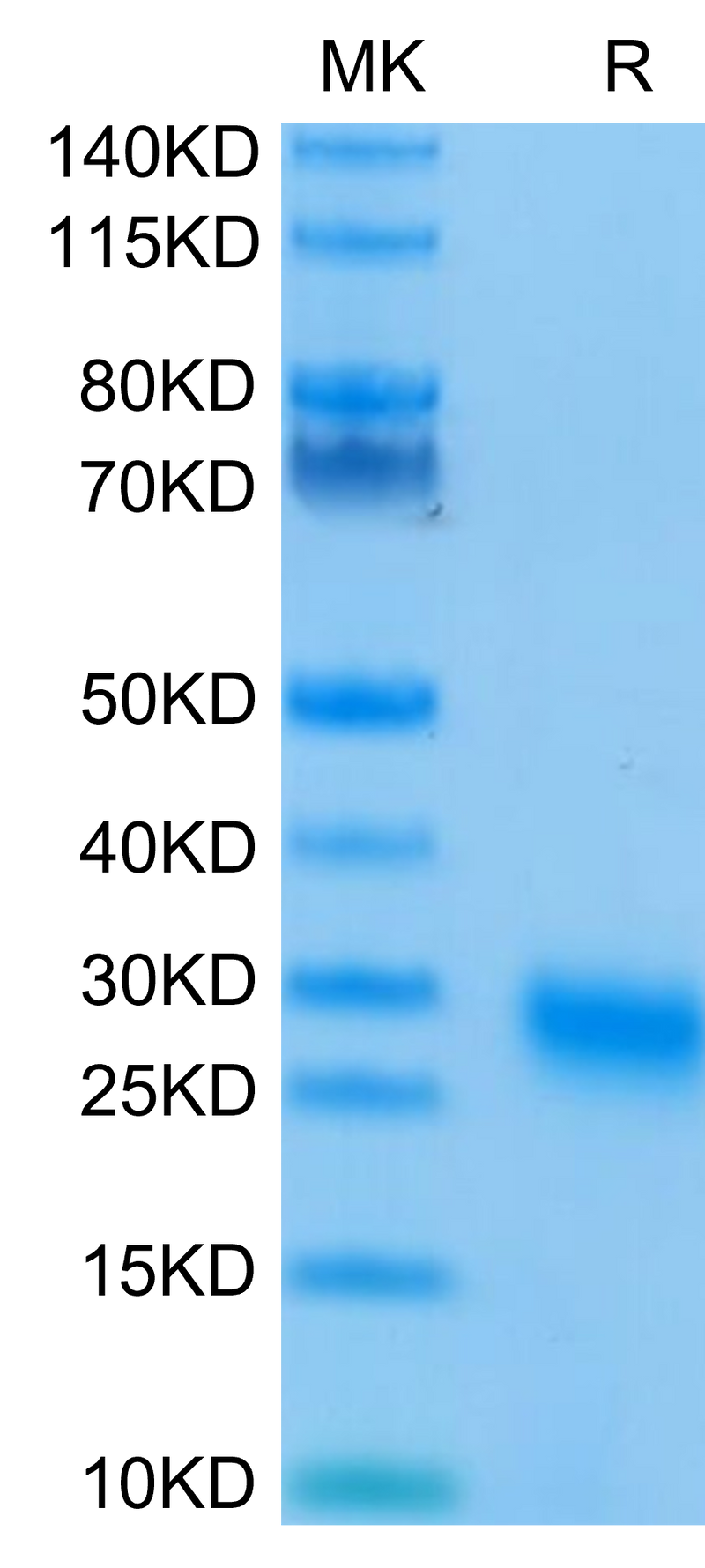Human GITR on Tris-Bis PAGE under reduced condition. The purity is greater than 95%Recombinant Human GITR/TNFRSF18 Protein, Active
