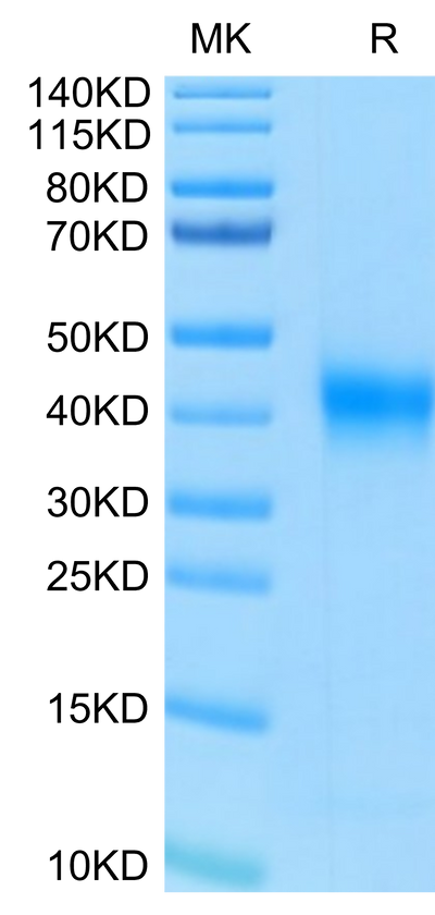 Human FOLR1 on Tris-Bis PAGE under reduced condition. The purity is greater than 95%.Recombinant Human FOLR1 Protein, Active