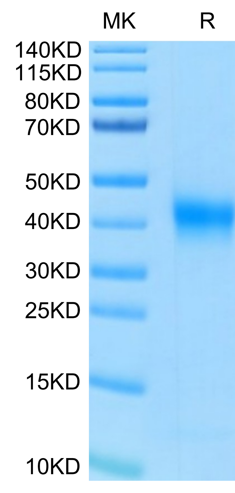 Human FOLR1 on Tris-Bis PAGE under reduced condition. The purity is greater than 95%.Recombinant Human FOLR1 Protein, Active