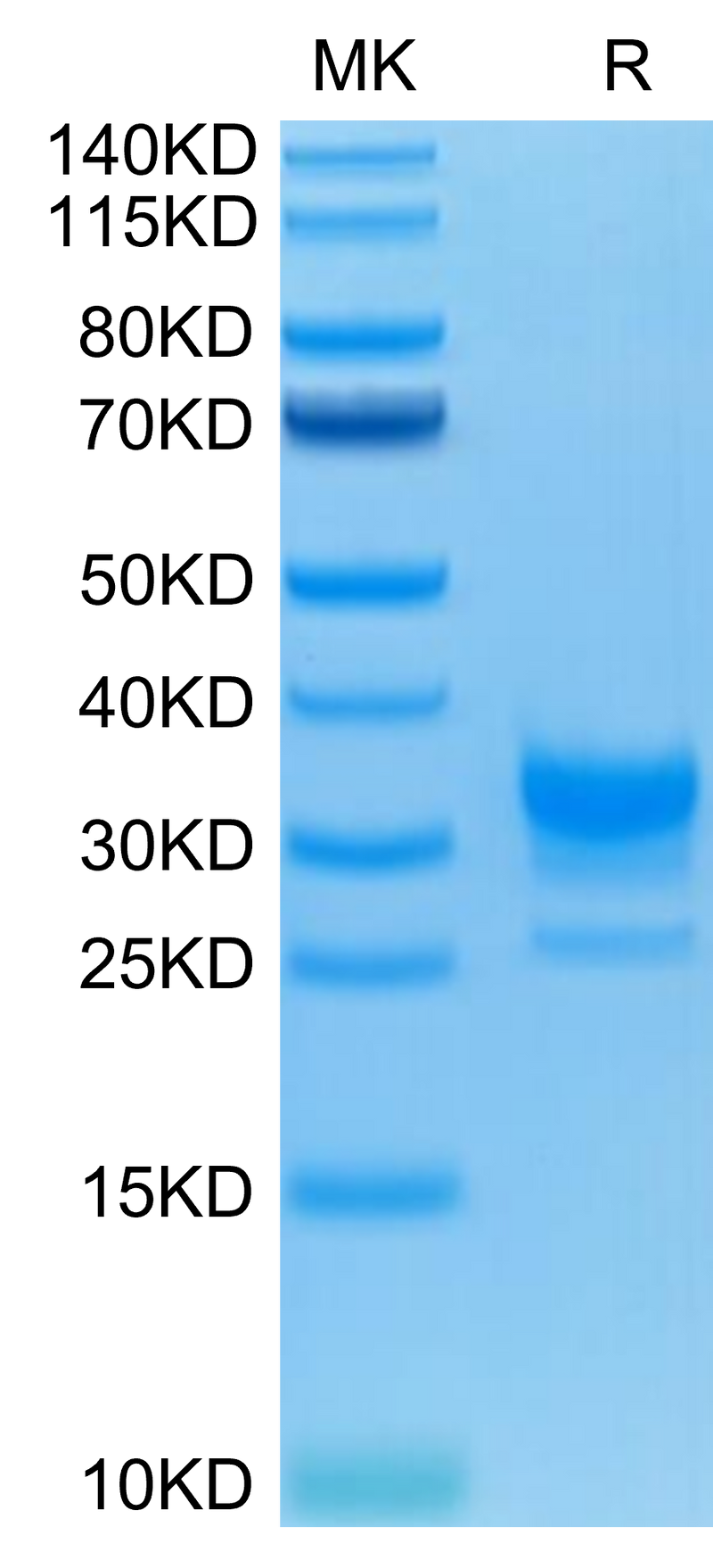 Human Fc gamma RIIB on Tris-Bis PAGE under reduced condition. The purity is greater than 95%.