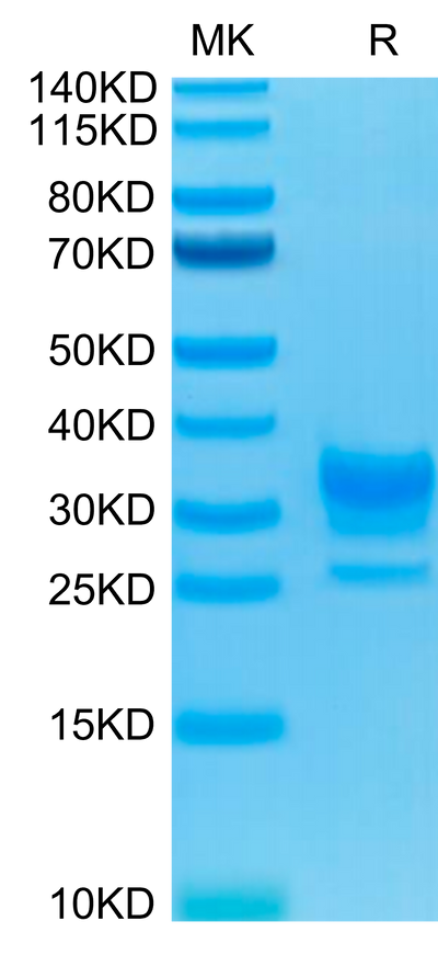 Biotinylated Human Fc gamma RIIB on Tris-Bis PAGE under reduced condition. The purity is greater than 95%.Biotinylated Human Fc gamma RIIB/CD32b Protein, Active