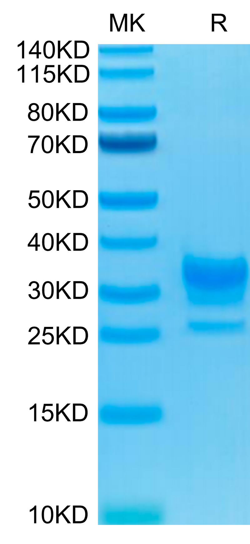 Biotinylated Human Fc gamma RIIB on Tris-Bis PAGE under reduced condition. The purity is greater than 95%.Biotinylated Human Fc gamma RIIB/CD32b Protein, Active