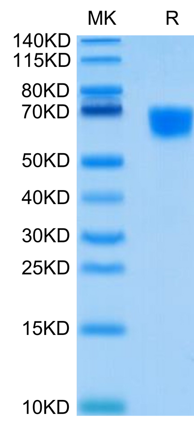 Human CD30 Ligand on Tris-Bis PAGE under reduced condition. The purity is greater than 95%.Recombinant Human CD30 Ligand/TNFSF8 Protein, Active