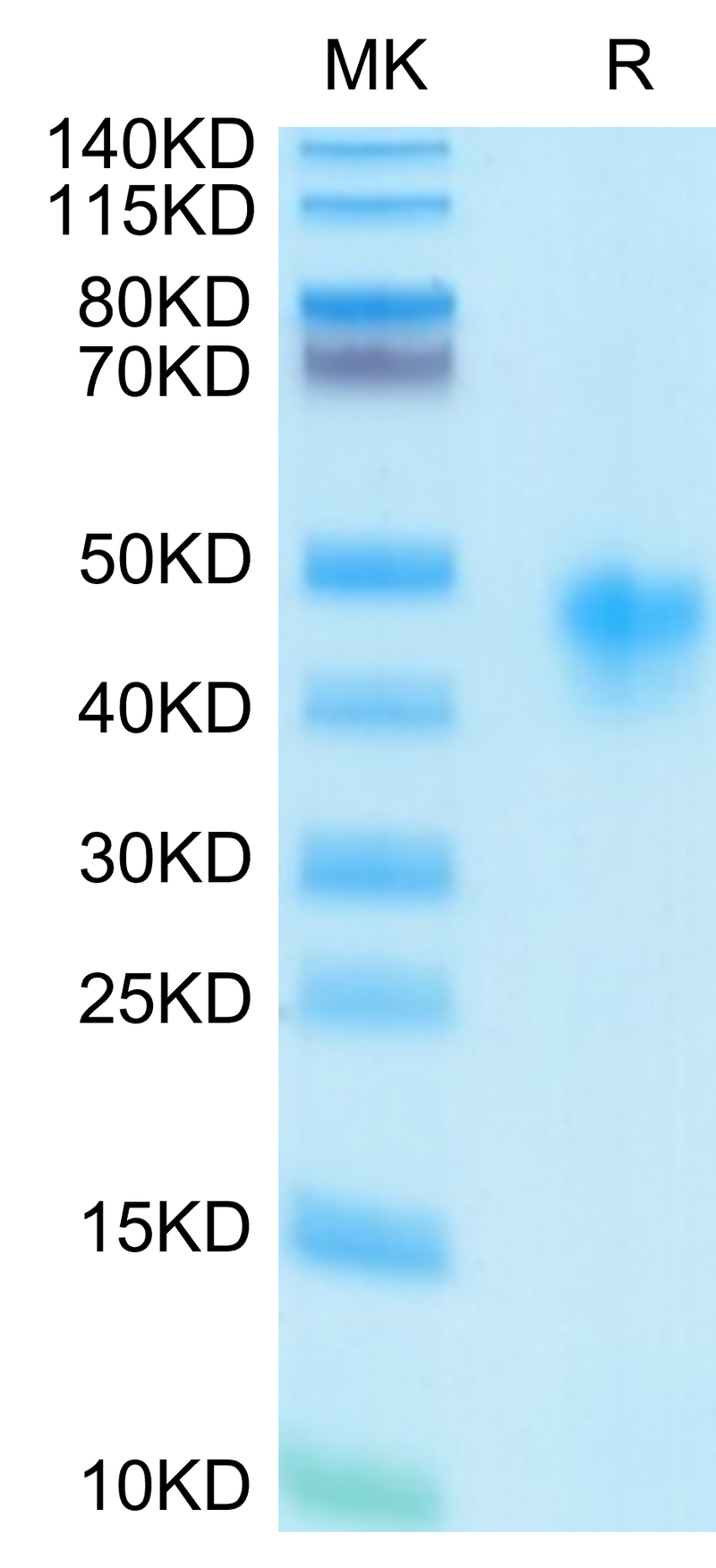 Human IL-2 R alpha on Tris-Bis PAGE under reduced condition. The purity is greater than 95%.Recombinant Human IL-2 R alpha/CD25 Protein, Active