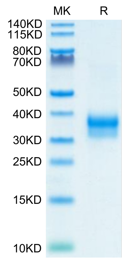 Mouse Siglec-15 on Tris-Bis PAGE under reduced condition. The purity is greater than 95%.Recombinant Mouse Siglec-15/CD33L3 Protein