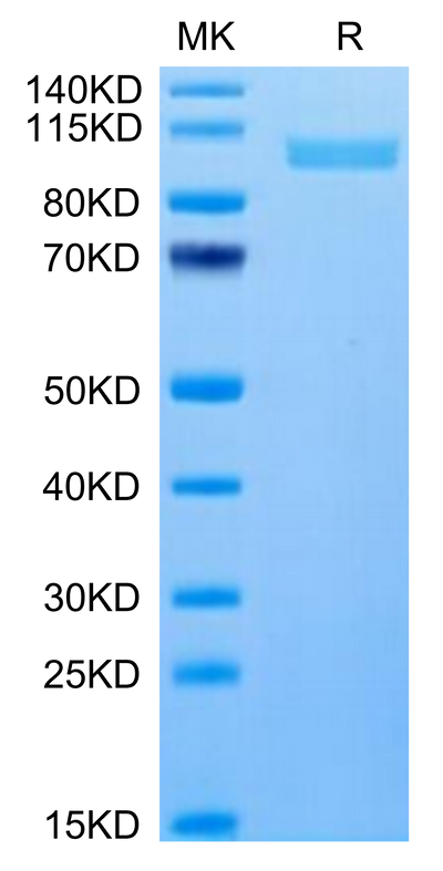 Human ITGA2B&ITGB3 on Tris-Bis PAGE under reduced condition. The purity is greater than 95%.Recombinant Human Integrin alpha 2B beta 3 (ITGA2B&ITGB3) Heterodimer Protein