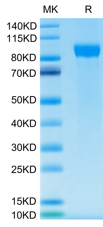 Human Her2 on Tris-Bis PAGE under reduced condition. The purity is greater than 95%.