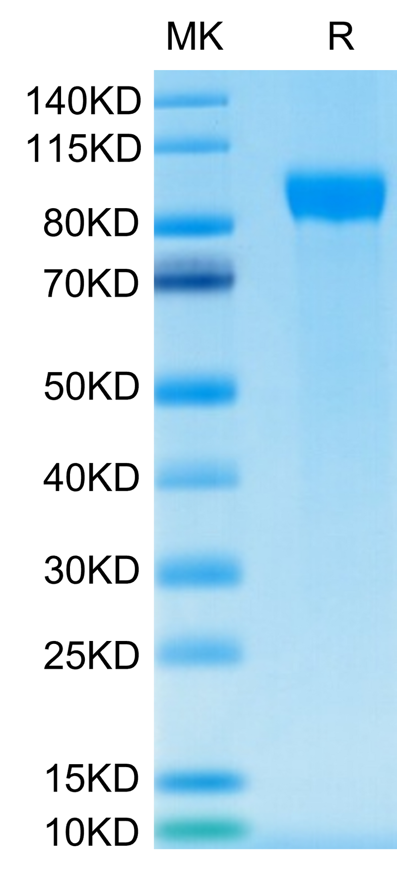 Human Her2 on Tris-Bis PAGE under reduced condition. The purity is greater than 95%.