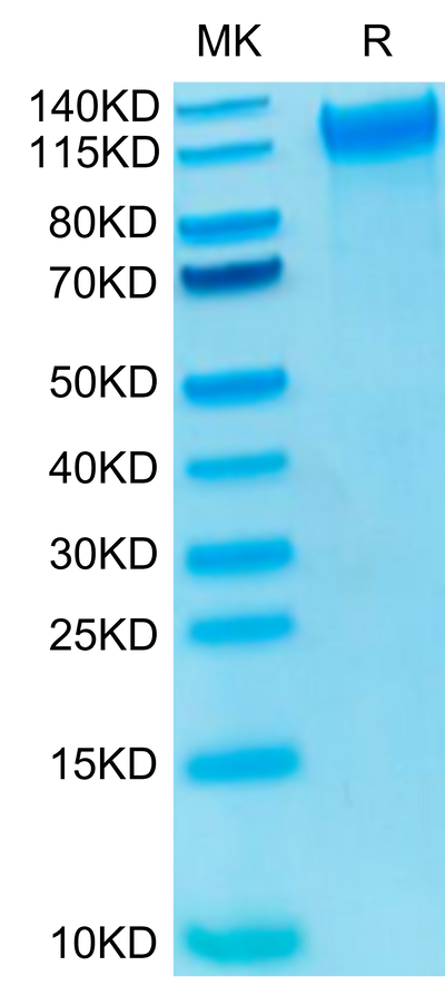 Biotinylated Human P-Selectin on Tris-Bis PAGE under reduced condition. The purity is greater than 95%.Biotinylated Human P-Selectin/CD62P Protein, Active
