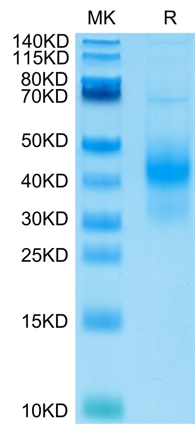 Human NKG2D on Tris-Bis PAGE under reduced condition. The purity is greater than 95%.Recombinant Human NKG2D/CD314 Protein, Active