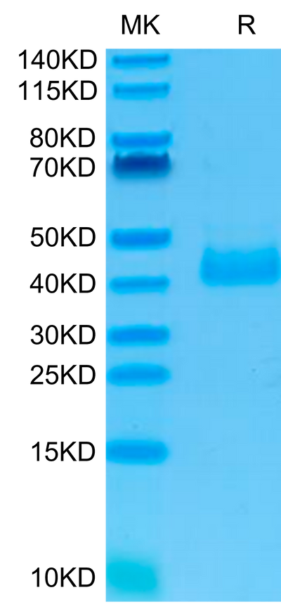 Human NKp46 on Tris-Bis PAGE under reduced condition. The purity is greater than 95%.Recombinant Human NKp46/NCR1/CD335 Protein, Active