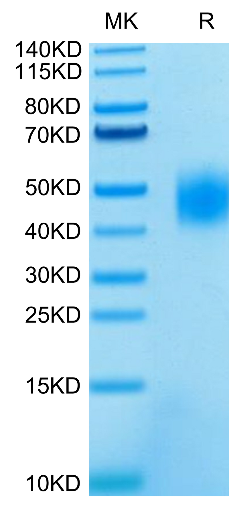 Human SLAMF7 on Tris-Bis PAGE under reduced condition. The purity is greater than 95%.Recombinant Human SLAMF7/CRACC/CD319 Protein, Active