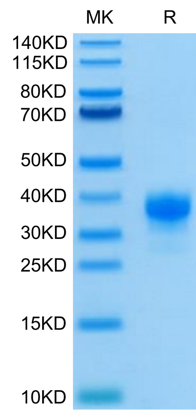 Human Fc gamma RIIA (R167) on Tris-Bis PAGE under reduced condition. The purity is greater than 95%.Recombinant Human Fc gamma RIIA/CD32a (R167) Protein, Active
