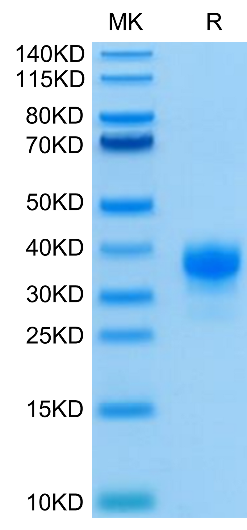 Human Fc gamma RIIA (R167) on Tris-Bis PAGE under reduced condition. The purity is greater than 95%.Recombinant Human Fc gamma RIIA/CD32a (R167) Protein, Active