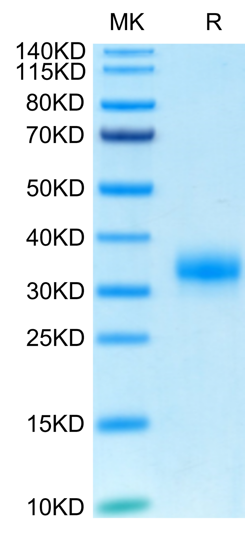 Biotinylated Human Fc gamma RIIA (R167) on Tris-Bis PAGE under reduced condition. The purity is greater than 95%.