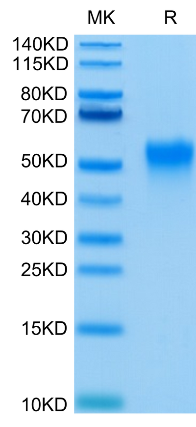 Human-Fc gamma RIIIA (V176) on Tris-Bis PAGE under reduced condition. The purity is greater than 95%.Recombinant Human Fc gamma RIIIA/CD16a (V176) Protein, Active