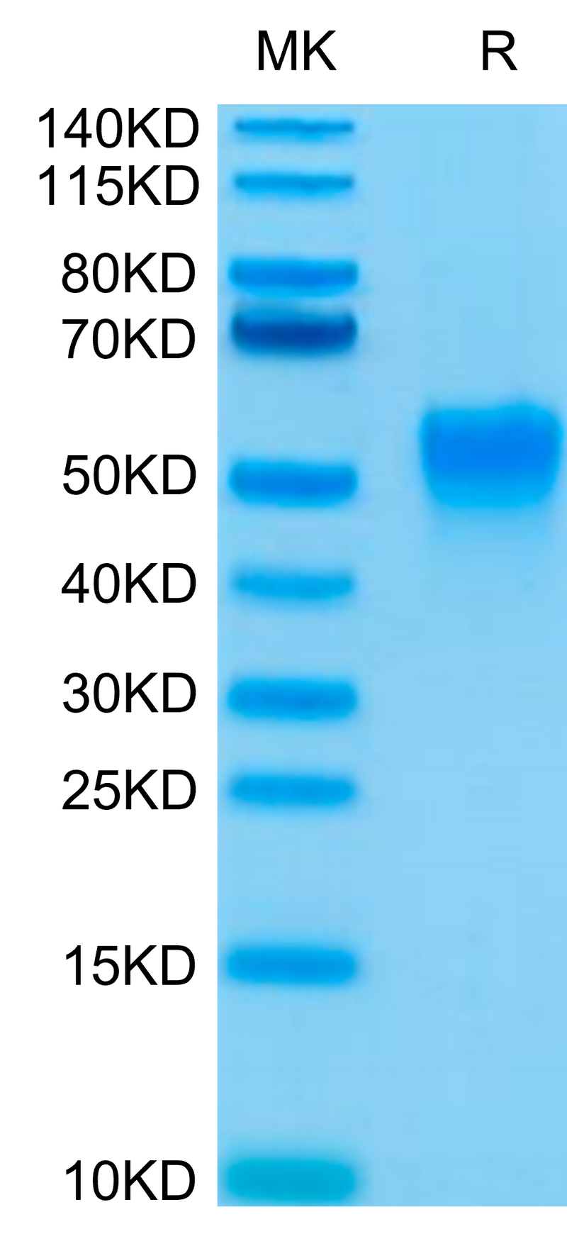 Biotinylated Human Fc gamma RIIIA (V176) on Tris-Bis PAGE under reduced condition. The purity is greater than 95%.Biotinylated Human Fc gamma RIIIA/CD16a (V176) Protein, Active