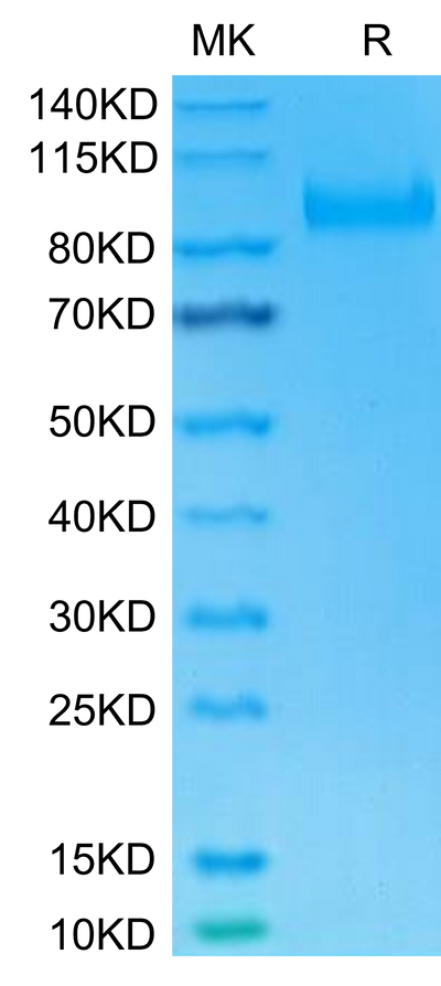 Human IL-23R on Tris-Bis PAGE under reduced condition. The purity is greater than 95%.Recombinant Human IL-23R Protein, Active