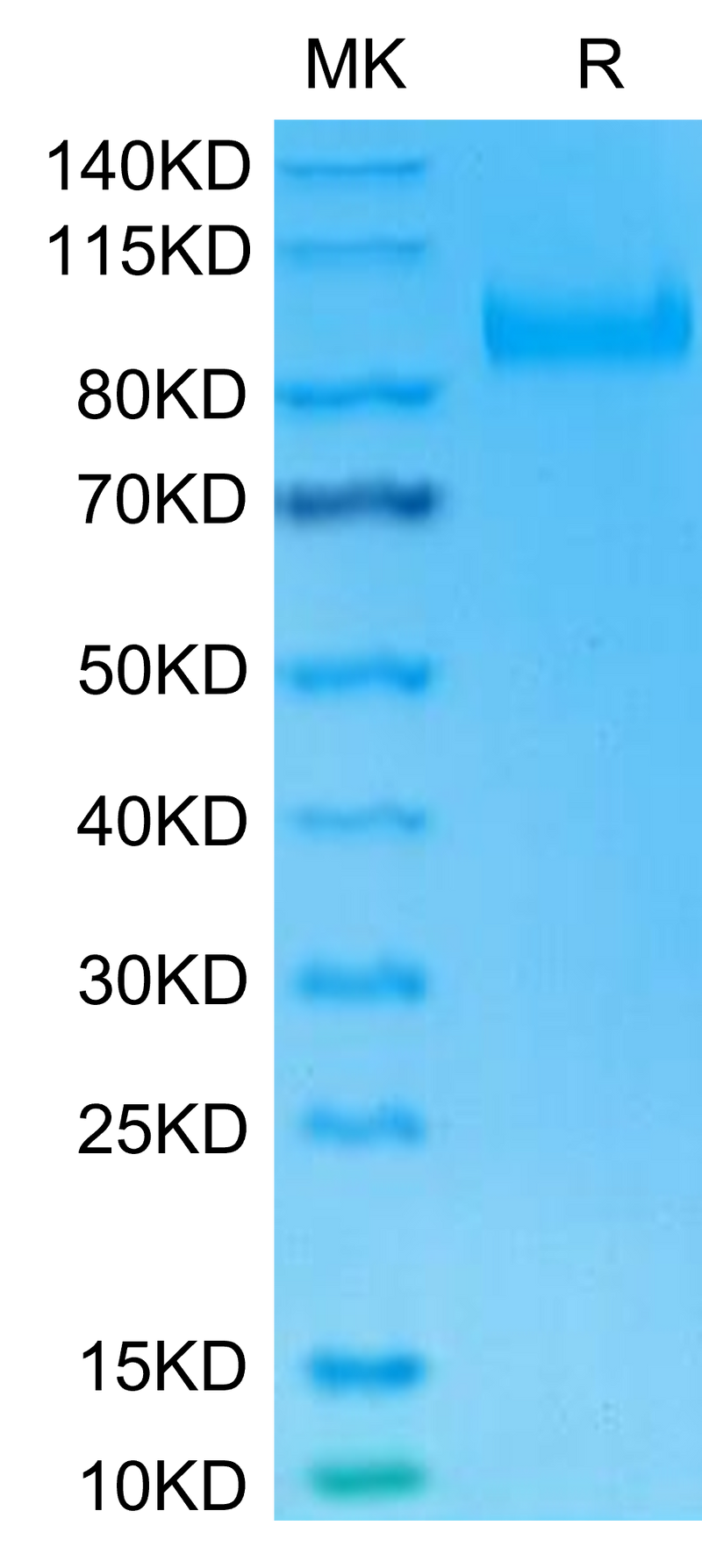 Human IL-23R on Tris-Bis PAGE under reduced condition. The purity is greater than 95%.Recombinant Human IL-23R Protein, Active