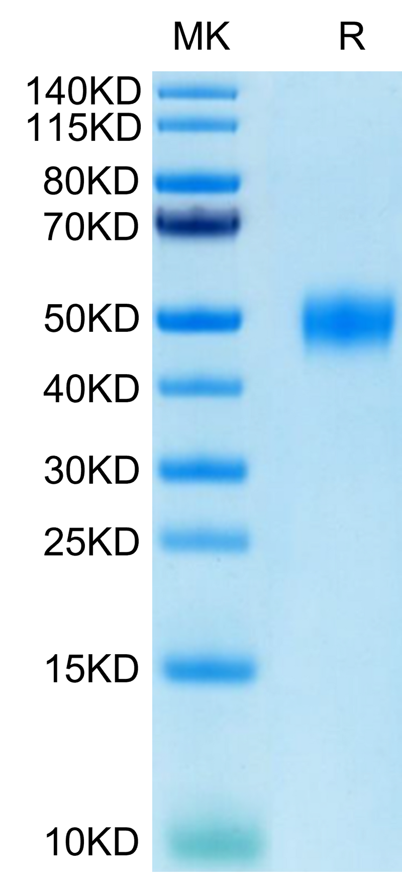 Human CD24 on Tris-Bis PAGE under reduced conditions. The purity is greater than 95%.Recombinant Human CD24 Protein, Active
