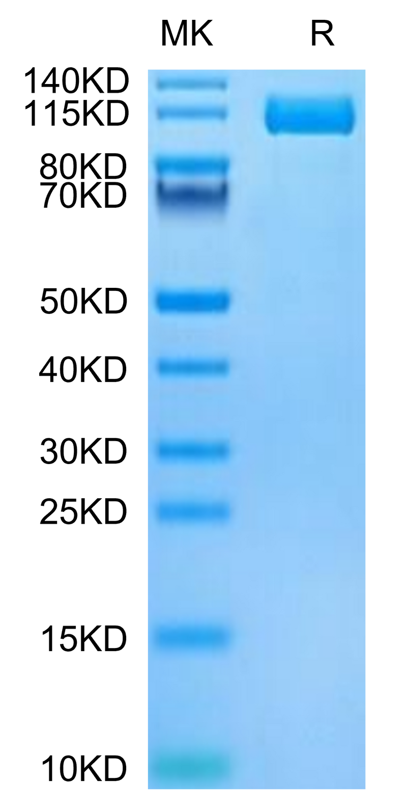 Biotinylated Human ENPP-3 on Tris-Bis PAGE under reduced condition. The purity is greater than 95%.Biotinylated Human ENPP-3 Protein