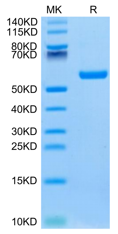 Human HLA-A*02:01&B2M&P53 WT (HMTEVVRRC) Monomer on Tris-Bis PAGE under reduced condition. The purity is greater than 95%.Recombinant Human HLA-A*02:01&B2M&P53 WT (HMTEVVRRC) Monomer Protein