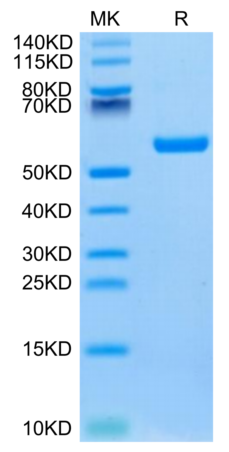 Human HLA-A*02:01&B2M&P53 WT (HMTEVVRRC) Monomer on Tris-Bis PAGE under reduced condition. The purity is greater than 95%.Recombinant Human HLA-A*02:01&B2M&P53 WT (HMTEVVRRC) Monomer Protein