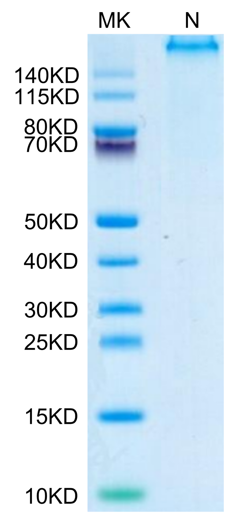 Human HLA-A*02:01&B2M&P53 WT (HMTEVVRRC) Tetramer on Tris-Bis PAGE under reduced condition. The purity is greater than 95%.Recombinant Human HLA-A*02:01&B2M&P53 WT (HMTEVVRRC) Tetramer Protein