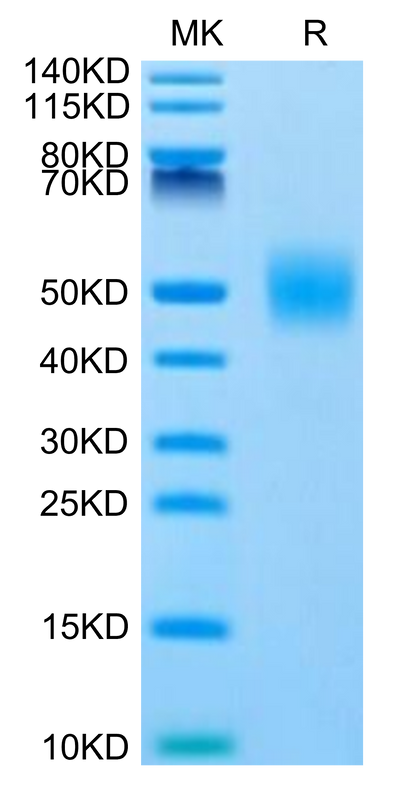 Human FGFR1 beta (IIIc) on Tris-Bis PAGE under reduced condition. The purity is greater than 95%.Recombinant Human FGFR1 beta (IIIc) Protein, Active