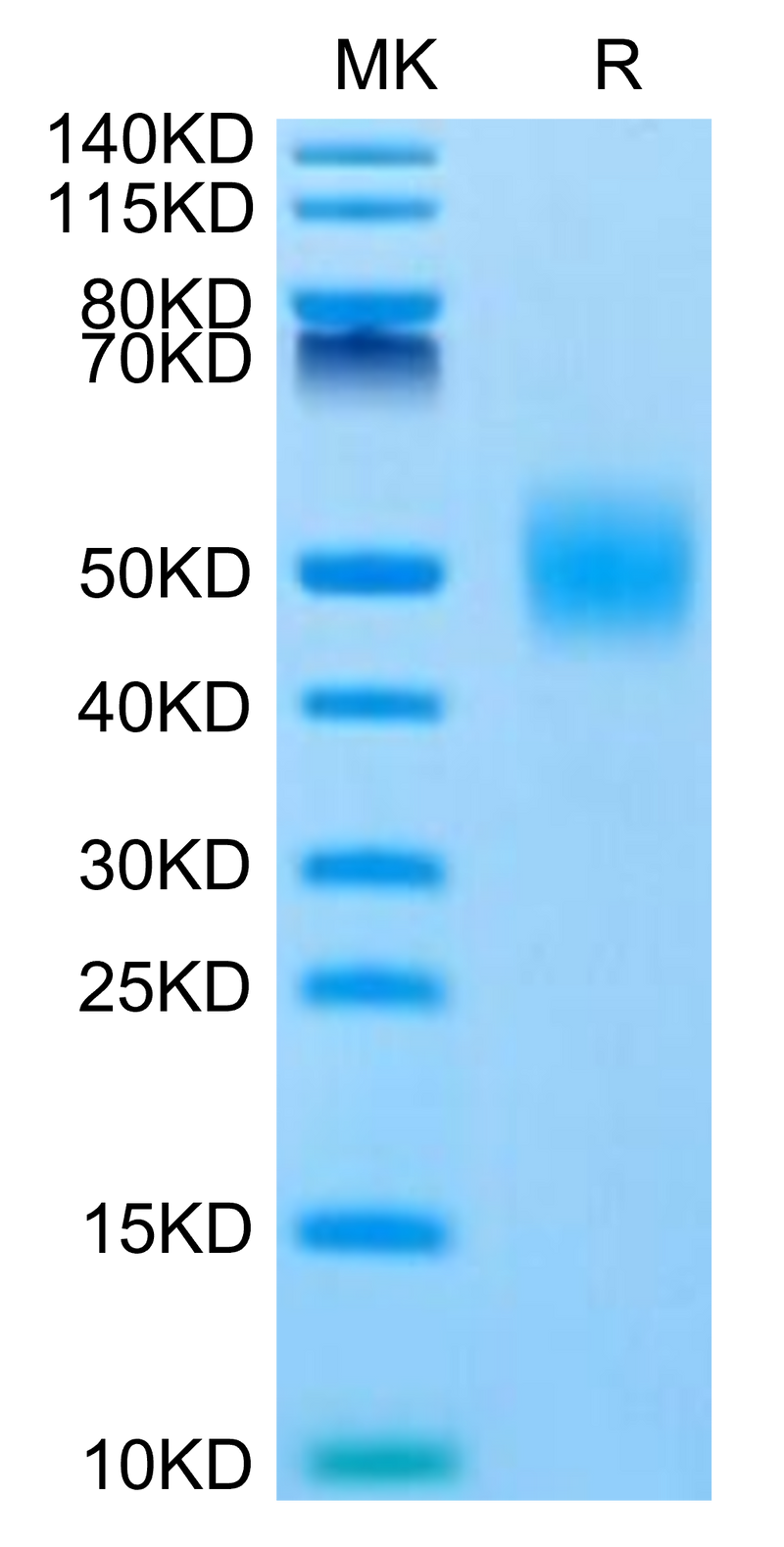Human FGFR1 beta (IIIc) on Tris-Bis PAGE under reduced condition. The purity is greater than 95%.Recombinant Human FGFR1 beta (IIIc) Protein, Active