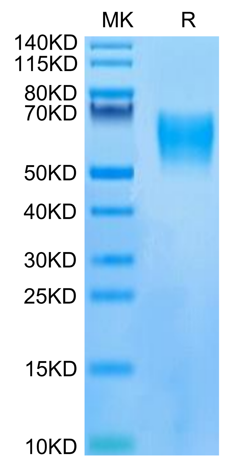 Human LILRB1 on Tris-Bis PAGE under reduced condition. The purity is greater than 95%.Recombinant Human LILRB1/CD85j/ILT2 Protein