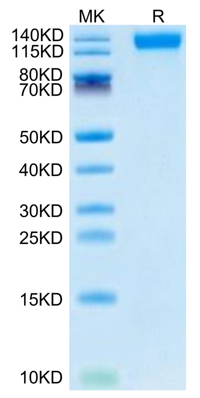 SARS-COV-2 Spike S1 (Omicron B.1.1.529) on Tris-Bis PAGE under reduced condition. The purity is greater than 95%.Recombinant SARS-COV-2 Spike S1 (Omicron B.1.1.529) Protein, Active