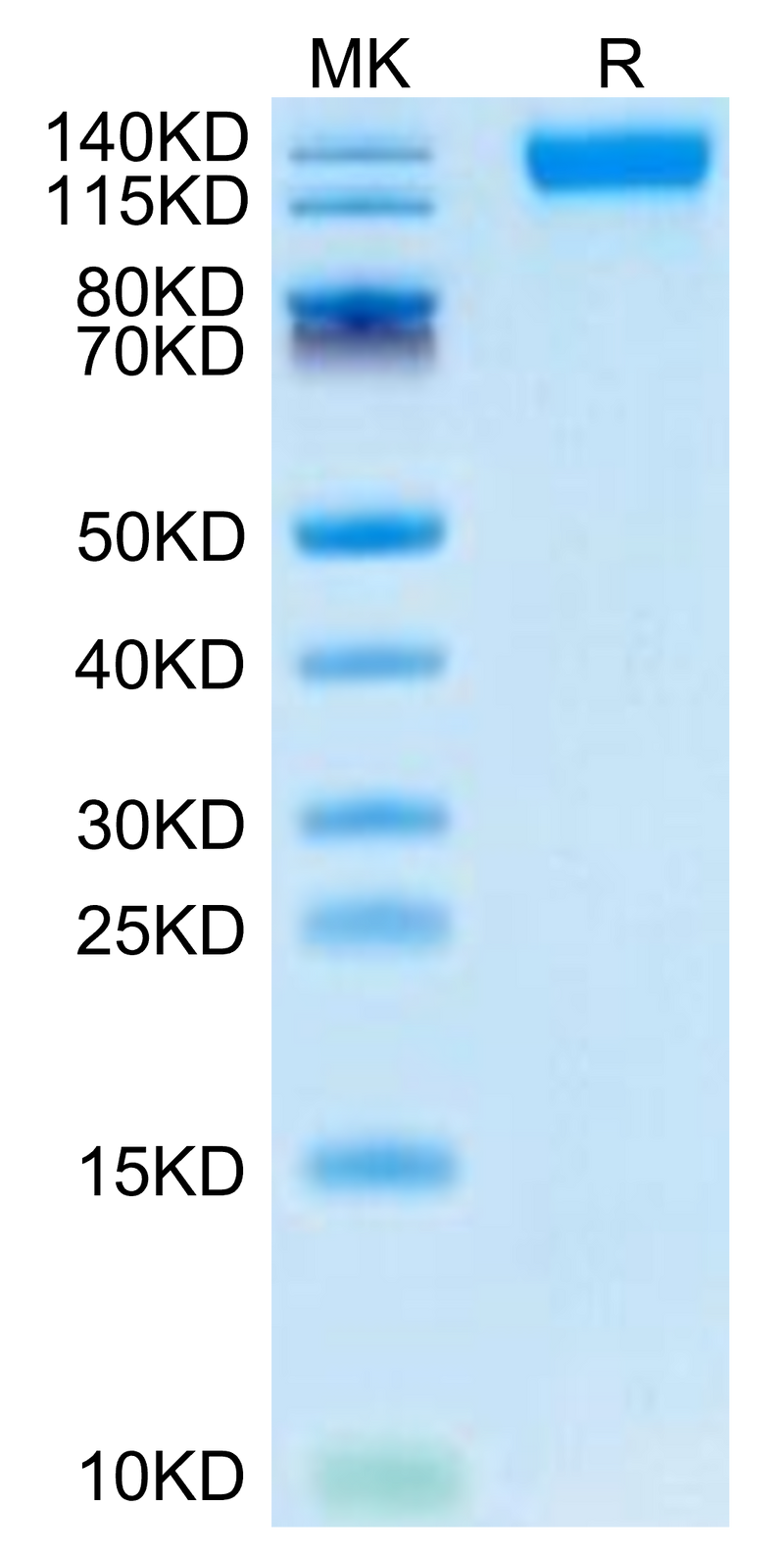 SARS-COV-2 Spike S1 (Omicron B.1.1.529) on Tris-Bis PAGE under reduced condition. The purity is greater than 95%.Recombinant SARS-COV-2 Spike S1 (Omicron B.1.1.529) Protein, Active