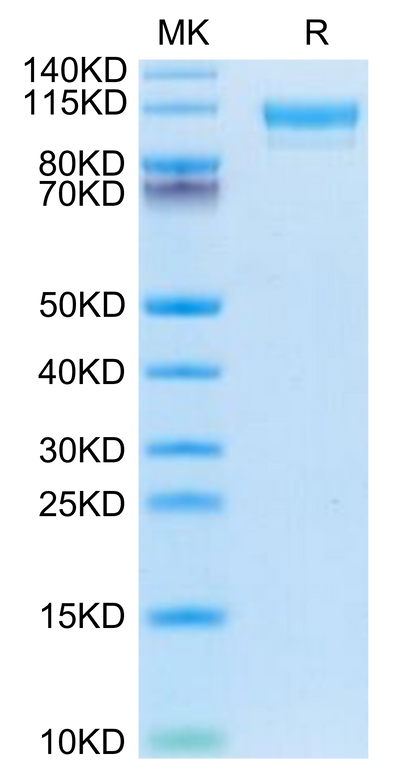 Mouse CD9P1 on Tris-Bis PAGE under reduced condition. The purity is greater than 95%.Recombinant Mouse CD9P1 Protein