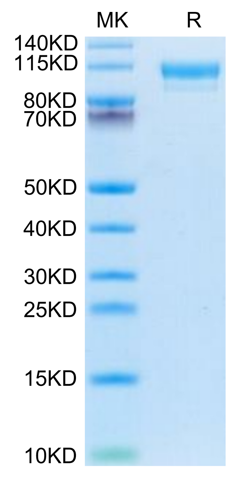 Mouse CD9P1 on Tris-Bis PAGE under reduced condition. The purity is greater than 95%.Recombinant Mouse CD9P1 Protein