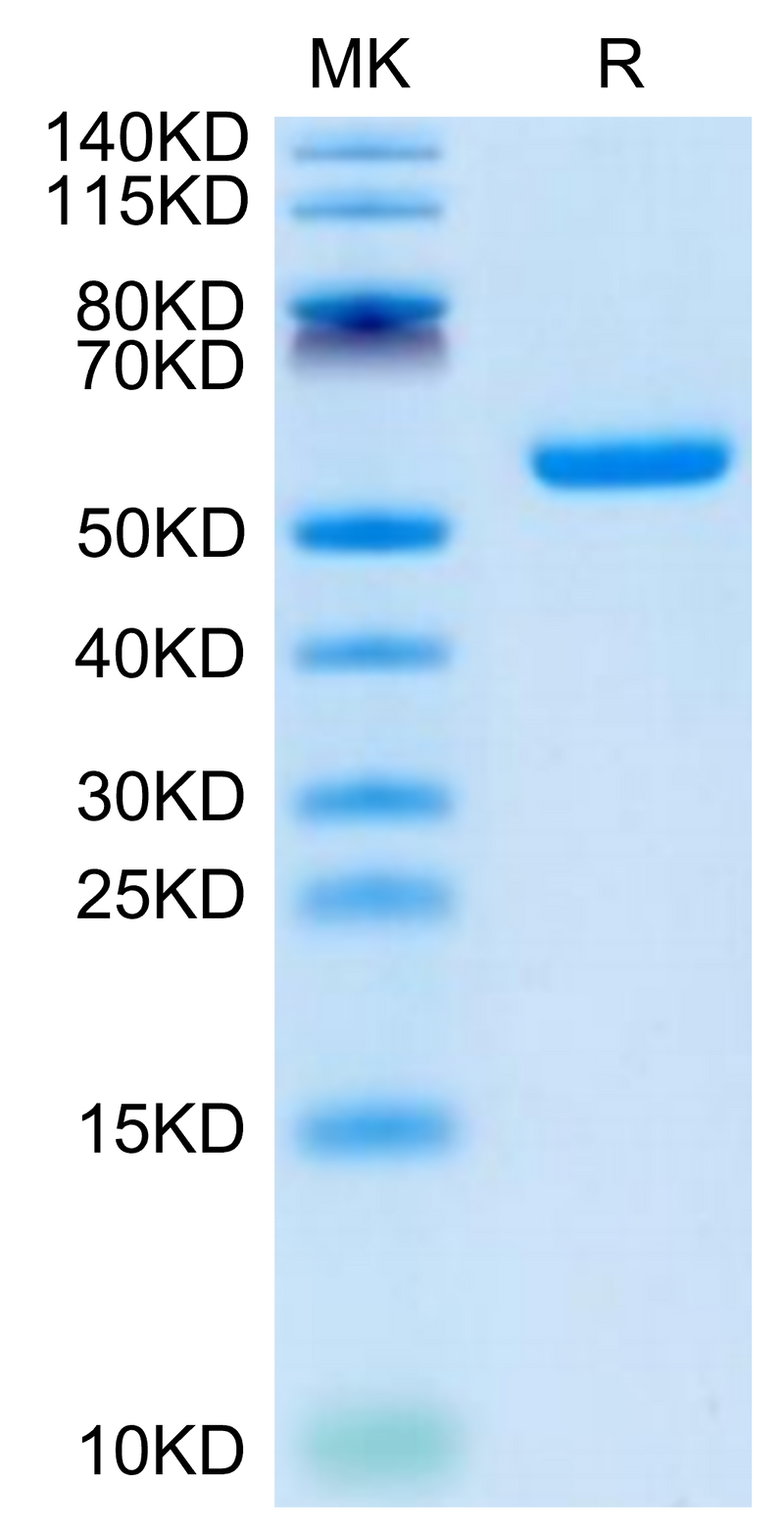 Human CSPG5 on Tris-Bis PAGE under reduced condition. The purity is greater than 95%.Recombinant Human CSPG5 Protein