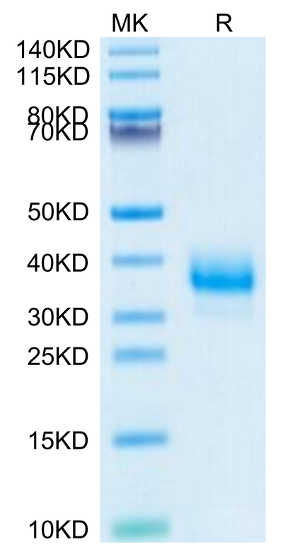 Cynomolgus Fc gamma RIIB on Tris-Bis PAGE under reduced condition. The purity is greater than 95%.Recombinant Cynomolgus Fc gamma RIIB Protein, Active