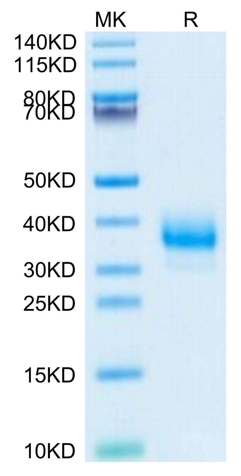 Cynomolgus Fc gamma RIIB on Tris-Bis PAGE under reduced condition. The purity is greater than 95%.Recombinant Cynomolgus Fc gamma RIIB Protein, Active