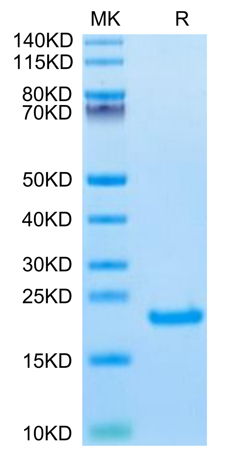 Biotinylated Human IL-21 on Tris-Bis PAGE under reduced condition. The purity is greater than 95%.Biotinylated Human IL-21 Protein, Active